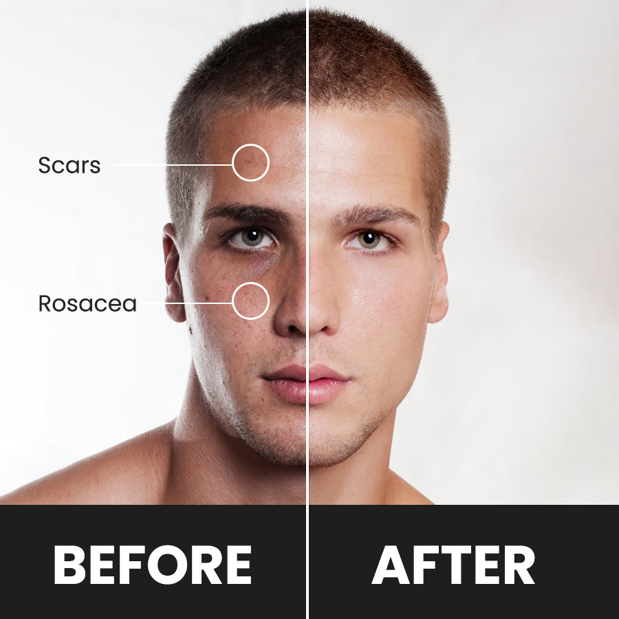 Concealer Tool For Every Man