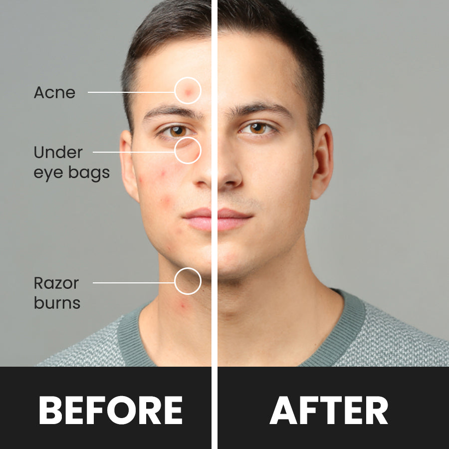 Concealer Tool For Every Man