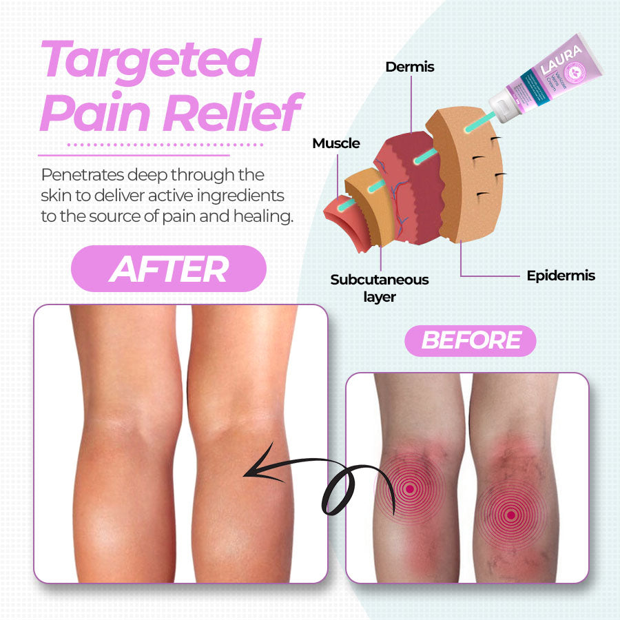 Laura Witch Hazel Varicose Veins Cream2