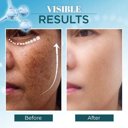 Lanthome™ Triple-Active Brightening Dark Spot Remover