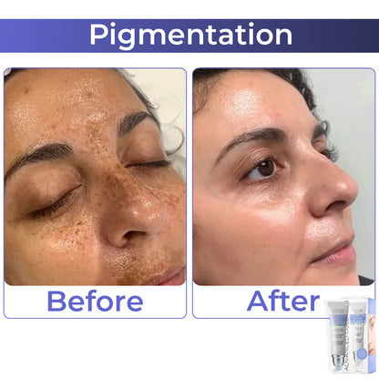 JEREMYTIS™ Advanced Collagen Complete Eye Cream